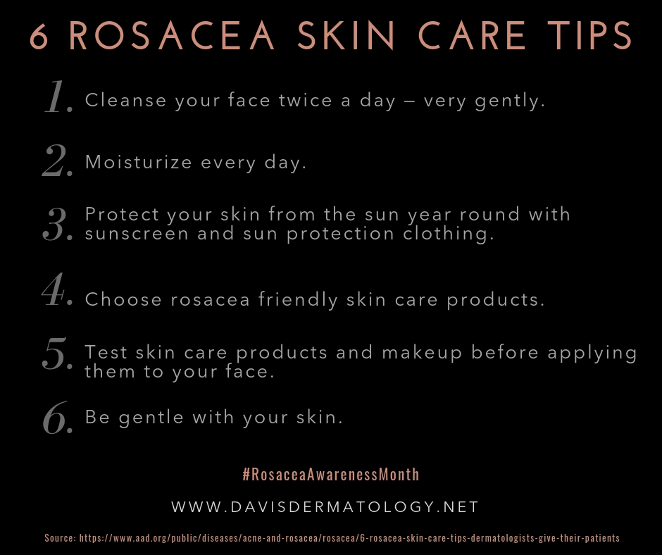 Understanding Rosacea – Symptoms, Diagnosis and Treatment - Noll ...